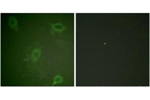 Immunofluorescence analysis of HeLa cells, using Amyloid beta A4 (Phospho-Thr743/668) Antibody. (APP 抗体  (pThr743))