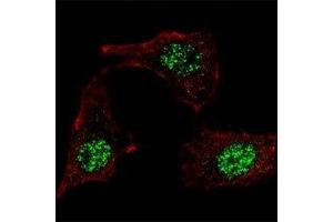 IF staining of HeLa cells with KLF4 antibody at 1:100, response is localized to the nuclei. (KLF4 抗体  (AA 69-101))