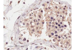 ABIN2559953 (4µg/ml) staining of paraffin embedded Human Testis. (SLC22A16 抗体  (Internal Region))