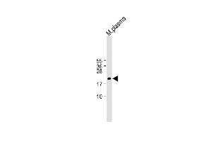 All lanes : Anti-GPX3 Antibody (Center) at 1:1000 dilution Lane 1: M. (GPX3 抗体  (AA 93-123))
