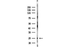 anti-Fibroblast Growth Factor 10 (FGF10) (C-Term) antibody