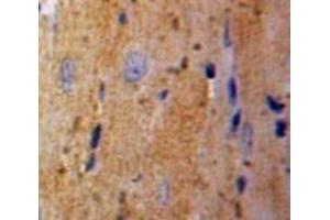 IHC-P analysis of Liver tissue, with DAB staining. (TPT1 抗体  (AA 1-172))