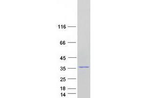 Transcription Elongation Factor A (SII)-Like 3 (TCEAL3) (Transcript Variant 1) protein (Myc-DYKDDDDK Tag)