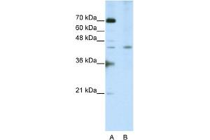 WB Suggested Anti-SURF6 Antibody Titration:  2. (SURF6 抗体  (Middle Region))