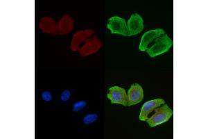ABIN6256965 and ABIN6274452 staining Hela cells(30 min of UV treatment) by IF/ICC.