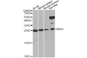 Western blot analysis of extracts of various cell lines, using BAK1 Antibody (ABIN5970038) at 1/1000 dilution. (BAK1 抗体  (N-Term))