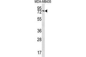 UNC84B Antibody (Center) western blot analysis in MDA-MB435 cell line lysates (35 µg/lane). (SUN2 抗体  (Middle Region))