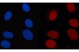 IF analysis of RANBP2 using anti-RANBP2 antibody (ABIN7602650). (RANBP2 抗体  (AA 906-2744))