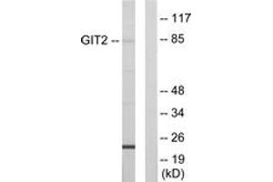 Western blot analysis of extracts from HepG2 cells, using GIT2 Antibody. (GIT2 抗体  (AA 361-410))