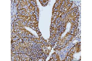 IHC analysis of CD147/Emmprin using anti-CD147/Emmprin antibody (ABIN7599999).