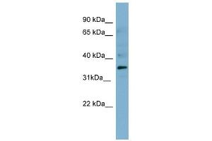 Mesothelin antibody used at 1 ug/ml to detect target protein.