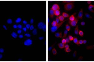 Human pancreatic carcinoma cell line MIA PaCa-2 was stained with Mouse Anti-Cytokeratin 18-UNLB and DAPI. (山羊 anti-小鼠 IgG (Heavy & Light Chain) Antibody (HRP) - Preadsorbed)