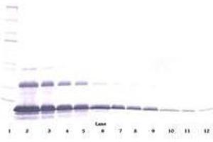 Image no. 3 for anti-Tumor Necrosis Factor Receptor Superfamily, Member 1A (TNFRSF1A) antibody (ABIN465074) (TNFRSF1A 抗体)