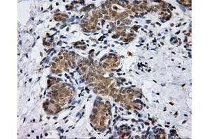 Immunohistochemical staining of paraffin-embedded breast tissue using anti-PTPRE mouse monoclonal antibody. (PTPRE 抗体)