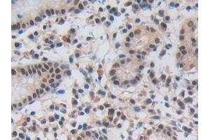 Immunohistochemistry (IHC) image for anti-Nucleoporin 50kDa (NUP50) (AA 37-269) antibody (ABIN7442900)