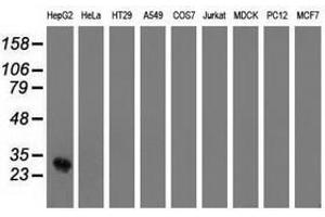 Image no. 2 for anti-OTU Domain, Ubiquitin Aldehyde Binding 2 (OTUB2) antibody (ABIN1499937) (OTUB2 抗体)