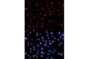 Immunofluorescence analysis of U2OS cells using Phospho-MEF2C-S396 antibody. (MEF2C 抗体  (pSer396))