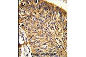 Immunohistochemistry (Paraffin-embedded Sections) (IHC (p)) image for anti-Peroxiredoxin 3 (PRDX3) (AA 66-94), (N-Term) antibody (ABIN389470)