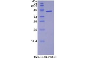 SDS-PAGE analysis of Mouse WFDC5 Protein. (WFDC5 蛋白)