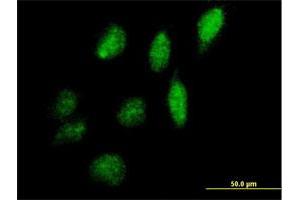 Immunofluorescence of purified MaxPab antibody to IPPK on HeLa cell. (IPPK 抗体  (AA 1-491))