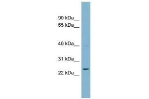 C7ORF29 antibody used at 1 ug/ml to detect target protein. (C7orf29 抗体  (Middle Region))