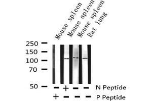 Western blot analysis of Phospho-NF kappaB p100/p52 (Ser869) expression in various lysates (NFKB2 抗体  (pSer870))