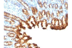 Immunohistochemistry (IHC) image for anti-Keratin 19 (KRT19) antibody (ABIN6939947)