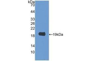 Detection of Recombinant GAL2, Rat using Polyclonal Antibody to Galectin 2 (GAL2) (Galectin 2 抗体  (AA 1-130))