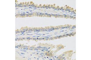 Immunohistochemistry of paraffin-embedded human prostate using INSL3 antibody at dilution of 1:100 (40x lens). (INSL3 抗体)