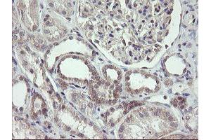 Image no. 5 for anti-F-Box Protein 42 (FBXO42) (AA 356-717) antibody (ABIN1491449)