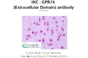Image no. 1 for anti-G Protein-Coupled Receptor 75 (GPR75) (2nd Extracellular Domain) antibody (ABIN1735159) (GPR75 抗体  (2nd Extracellular Domain))