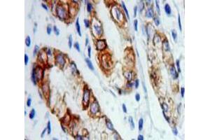 Used in DAB staining on fromalin fixed paraffin-embedded Stomach tissue (VAPA 抗体  (AA 1-249))