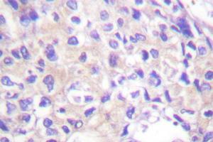Image no. 1 for anti-Ribosomal Protein S6 Kinase, 90kDa, Polypeptide 1 (RPS6KA1) antibody (ABIN271935) (RPS6KA1 抗体)