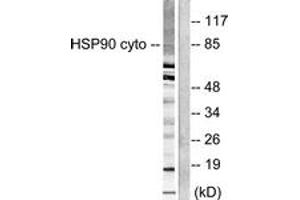 Western blot analysis of extracts from NIH-3T3 cells, using HSP90A Antibody. (HSP90AA1 抗体  (AA 683-732))