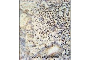 Immunohistochemistry (Paraffin-embedded Sections) (IHC (p)) image for anti-Epithelial Splicing Regulatory Protein 1 (ESRP1) (AA 182-211) antibody (ABIN652121)