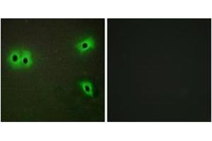 Immunofluorescence analysis of A549 cells, using Collagen XIII alpha1 Antibody. (COL13A1 抗体  (AA 641-690))