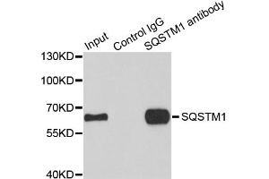Immunoprecipitation analysis of 100ug extracts of HepG2 cells using 3ug SQSTM1 antibody. (SQSTM1 抗体)