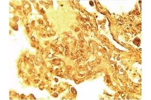 Image no. 1 for anti-serine Palmitoyltransferase, Long Chain Base Subunit 1 (SPTLC1) antibody (ABIN4620353) (SPTLC1 抗体)