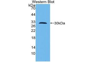 Western blot analysis of the recombinant protein. (TLR10 抗体  (AA 20-250))