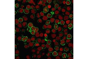 Immunofluorescence staining of Raji cells using CD20 Mouse Recombinant Monoclonal Antibody (rIGEL/773) followed by goat anti-Mouse IgG conjugated to CF488 (green). (Recombinant CD20 抗体)