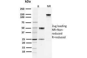 SDS-PAGE Analysis Purified PD-L1 Mouse Monoclonal Antibody (PDL1/2744). (PD-L1 抗体  (AA 39-191))