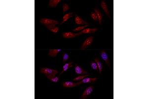 Confocal immunofluorescence analysis of U-2OS cells using EIF6 antibody (ABIN3022602, ABIN3022603, ABIN3022604 and ABIN6218936) at dilution of 1:50. (EIF6 抗体  (AA 1-245))