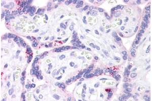 Human Placenta: Formalin-Fixed, Paraffin-Embedded (FFPE)