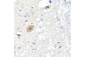 Immunohistochemistry of paraffin-embedded rat brain using FGF13 antibody. (FGF13 抗体)