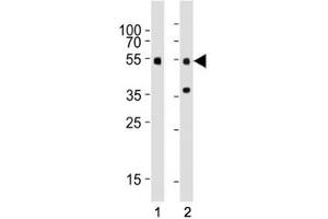 Western blot testing of Smad3 antibody at 1:1000 dilution.