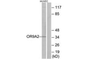 Western blot analysis of extracts from HuvEc cells, using OR9A2 Antibody. (OR9A2 抗体  (AA 260-309))