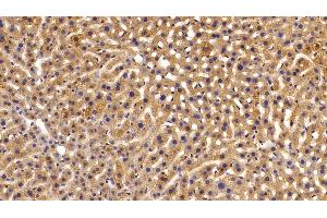 Immunohistochemistry (IHC) image for anti-serpin Peptidase Inhibitor, Clade A (Alpha-1 Antiproteinase, Antitrypsin), Member 1 (SERPINA1) (AA 25-413) antibody (ABIN7429055)