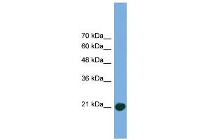WB Suggested Anti-COMMD8 Antibody Titration: 0. (COMMD8 抗体  (Middle Region))