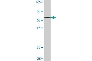Western Blot detection against Immunogen (60. (MAGEA11 抗体  (AA 1-319))