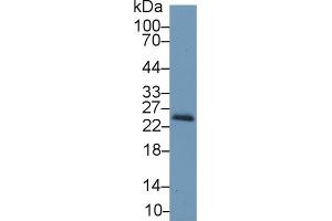 Western blot analysis of Mouse Kidney lysate, using Mouse RBP4 Antibody (1 µg/ml) and HRP-conjugated Goat Anti-Rabbit antibody ( (RBP4 抗体  (AA 63-245))